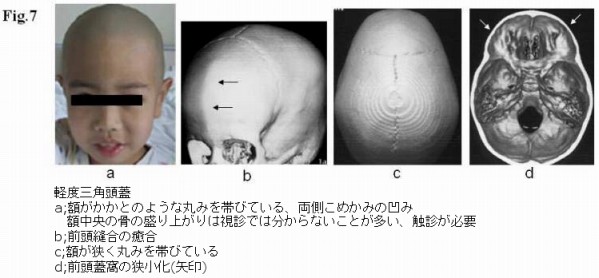 添付画像