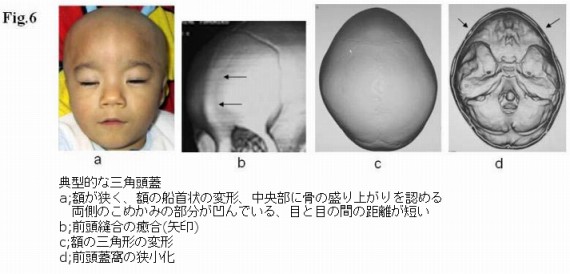 添付画像