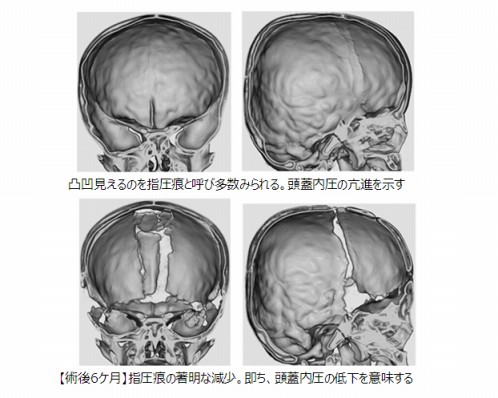 添付画像