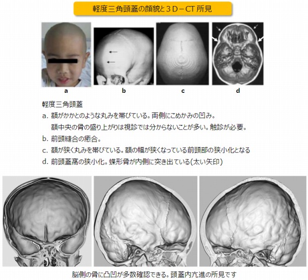 添付画像