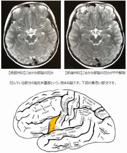 添付画像